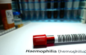 hemofilia u dzieci